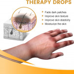 JAYSUING Therapy Drops-Reduce Dark Spot & Lightens Skin Discoloration-একটার দামে দুইটা